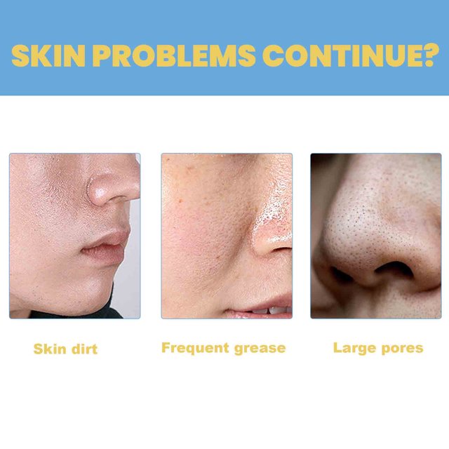 Clarifying Blackhead Serum for Smooth, Radiant Skin